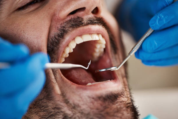 Best Broken Tooth Emergency  in Somerdale, NJ